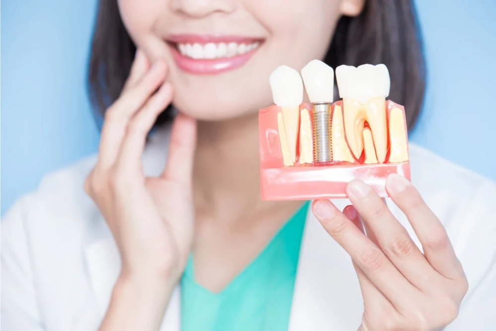 Dental İmplant